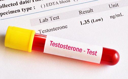 photo of abnormal low testosterone hormone test result