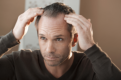 Hair Loss Treatment for Men & Women | Men's Health Atlanta